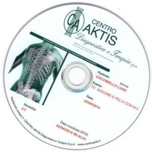 CD ESITO TAC FINALE